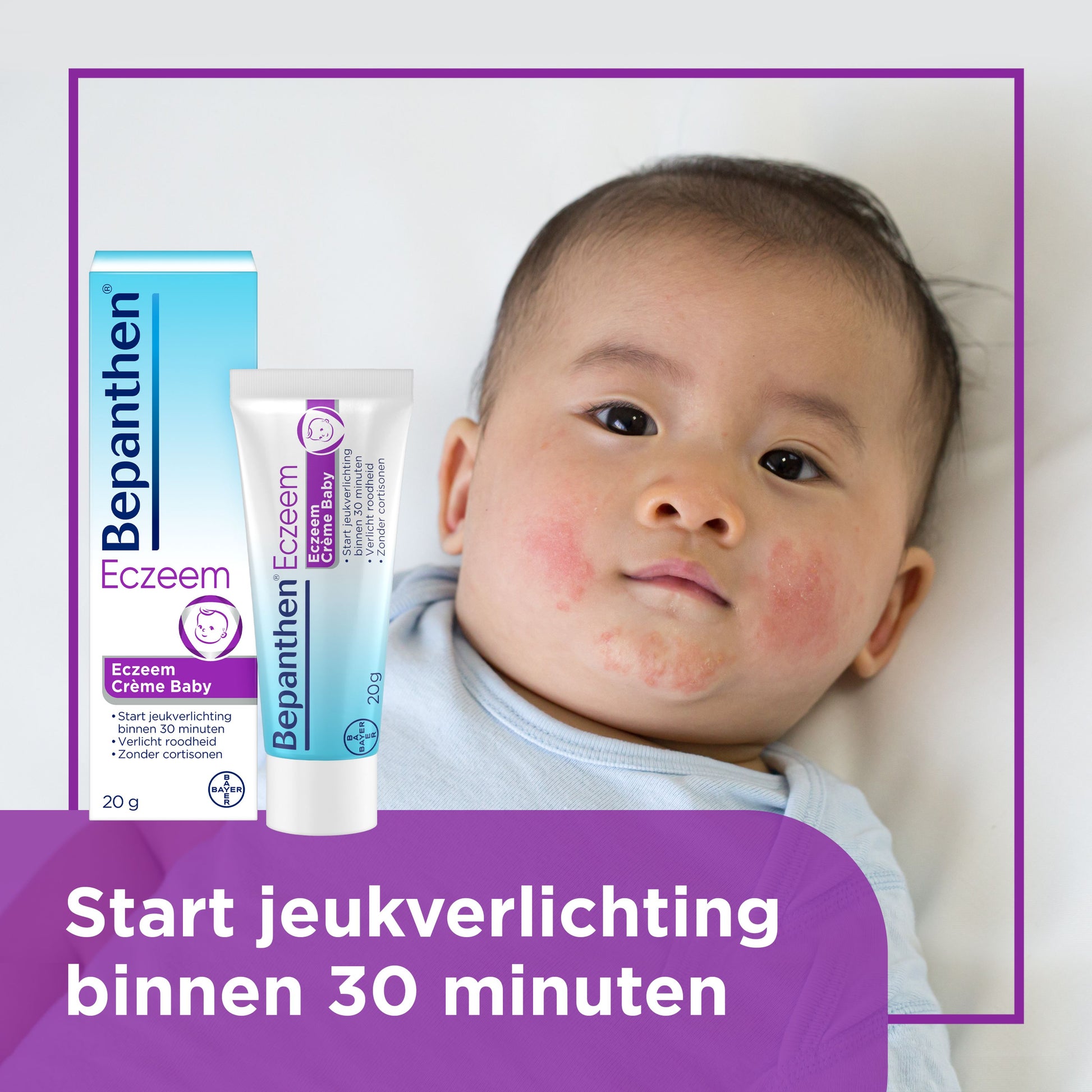 Bepanthen Eczeem baby creme 20 Gram