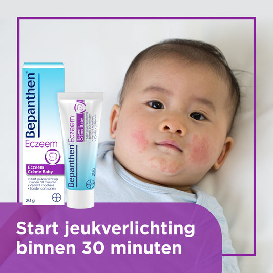 Bepanthen Eczeem baby creme 20 Gram